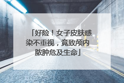 好险！女子皮肤感染不重视，竟致颅内脓肿危及生命